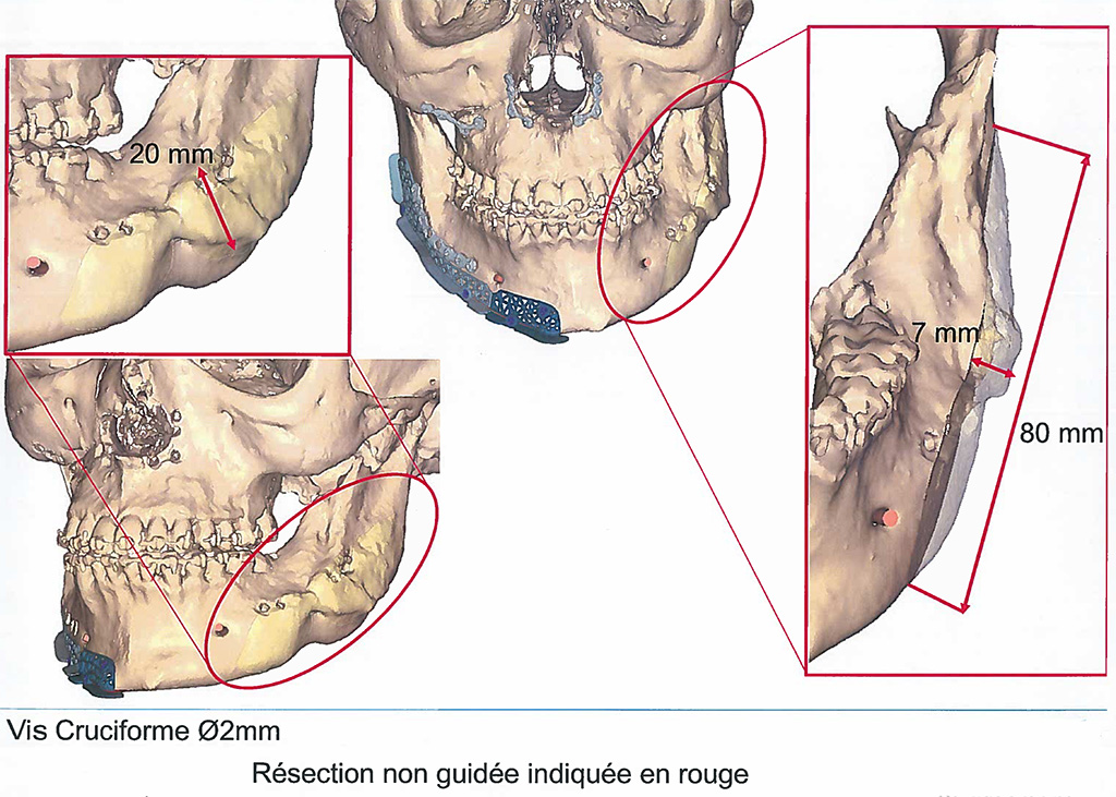 Exemple image 3D