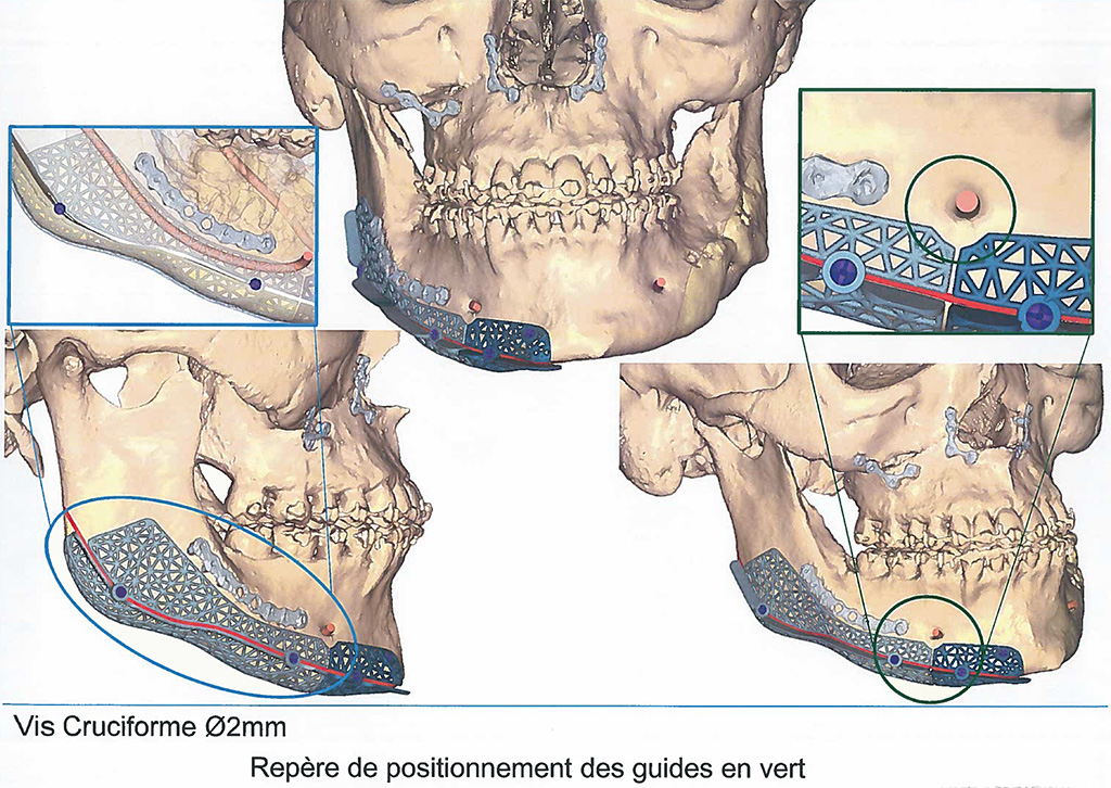 Exemple image 3D