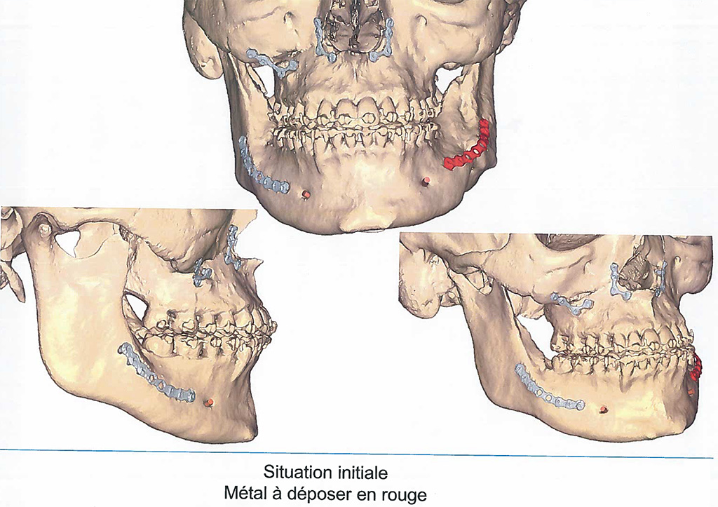 Exemple image 3D